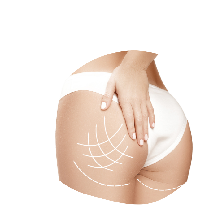 https://medviservices.com/wp-content/uploads/2024/09/Fesses-1.png