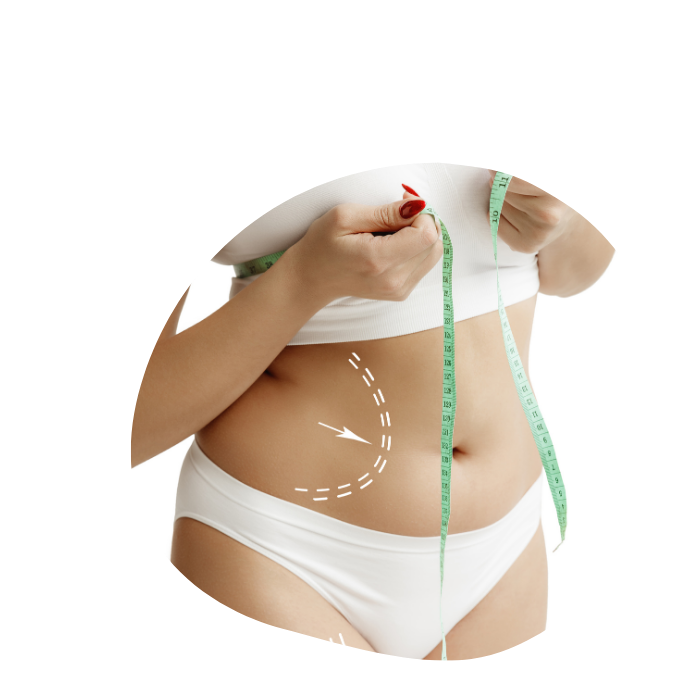 https://medviservices.com/wp-content/uploads/2024/09/Lipo.png
